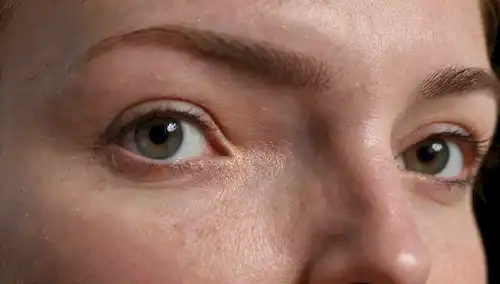 3D rendering of a human face, smooth and brighting skin, small dots or micro-punctures on forehead, finas líneas y arrugas reducidas, sutil iluminación resaltando poros, textura suave alrededor de la boca, enfoque suave para enfatizar resultados