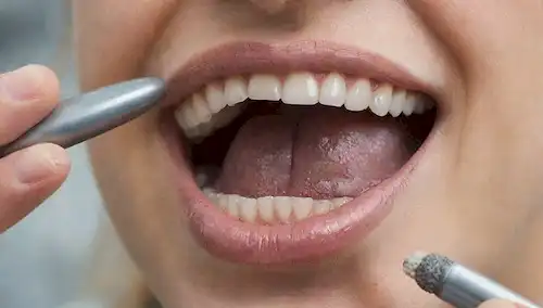 Una boca de personas con una superficie áspera y granular