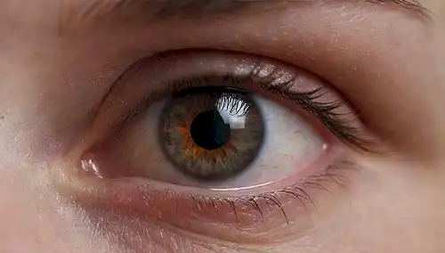 Primer plano, ojos con membrana conjuntiva, enrojecimiento, hinchazón, descarga, párpados hinchados de cierre, lágrimas que fluyen hacia abajo, foco borroso, tono cálido, luz natural