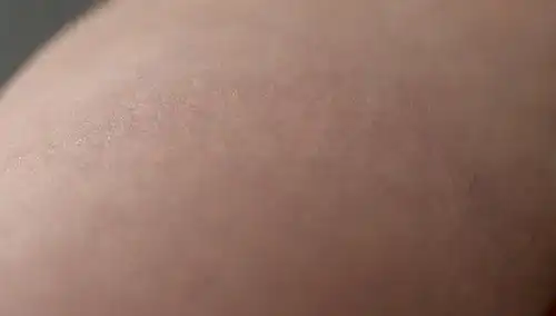 Primer plano de la piel, suaves movimientos de mano, finos objetos parecidos a agujas, sutil enrojecimiento, irritación menor, apariencia rejuvenecida, brillo juvenil, folículos de pelo, textura del cuero cabelludo, fondo calmante, fuente de luz calmante